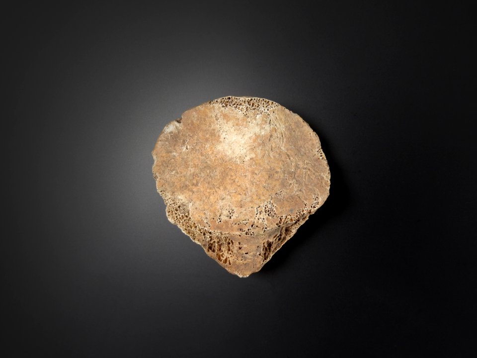 Patella - facies posterior patellae detail