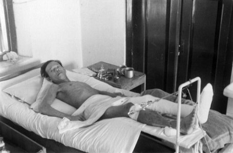 Patient met verwondingen aan benen ligt op een hospitaalbed, Bestanddeelnr 6491 photo