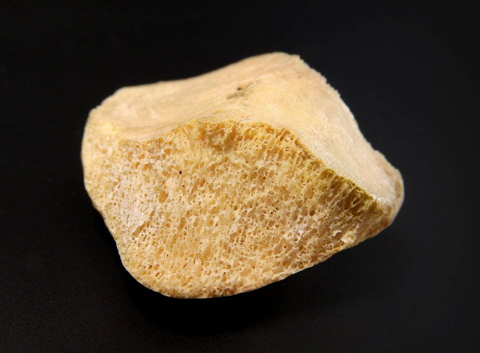 Patella - detail of bone tissue