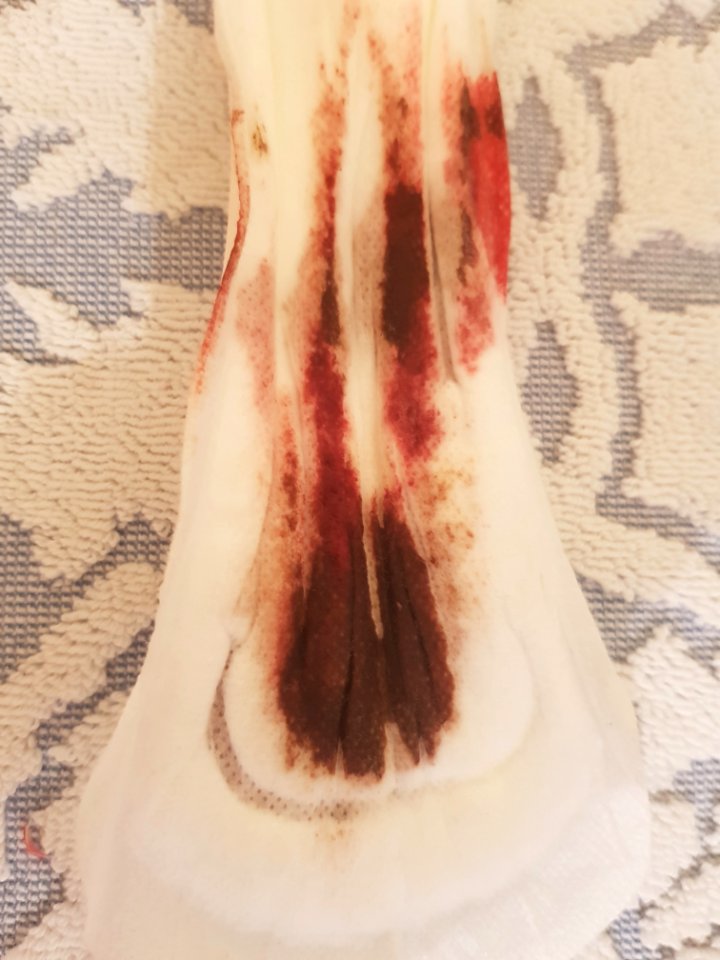 Sang menstruel sur serviette hygiénique 