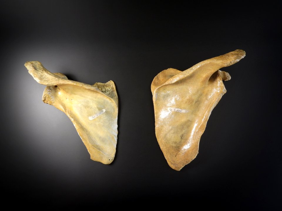 Scapula - posterior view 2