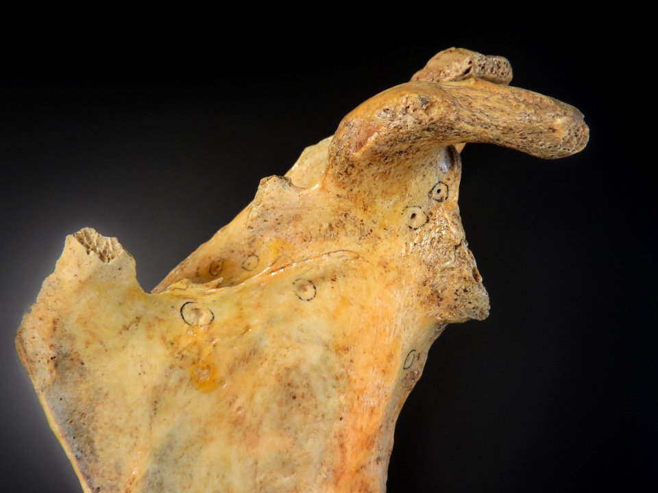 Scapula - processus coracoideus