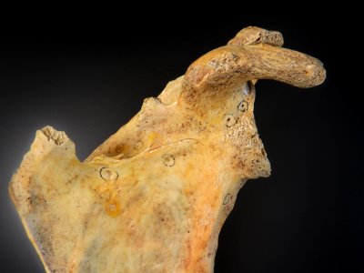 Scapula - processus coracoideus