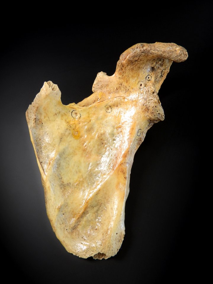 Scapula - anterior (damaged bone)