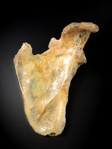 Scapula - anterior (damaged bone)
