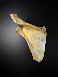 Scapula - posterior view