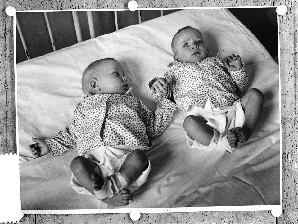 Siamese tweeling Folkje en Tjitske de Vries succesvol door operatie gescheiden, Bestanddeelnr 906-5295