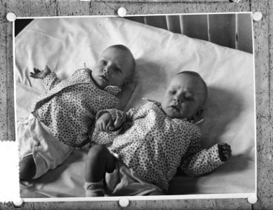 Siamese tweeling Folkje en Tjitske de Vries succesvol door operatie gescheiden, Bestanddeelnr 906-5296