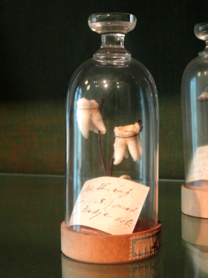 Teeth - Arppeanum - DSC05429