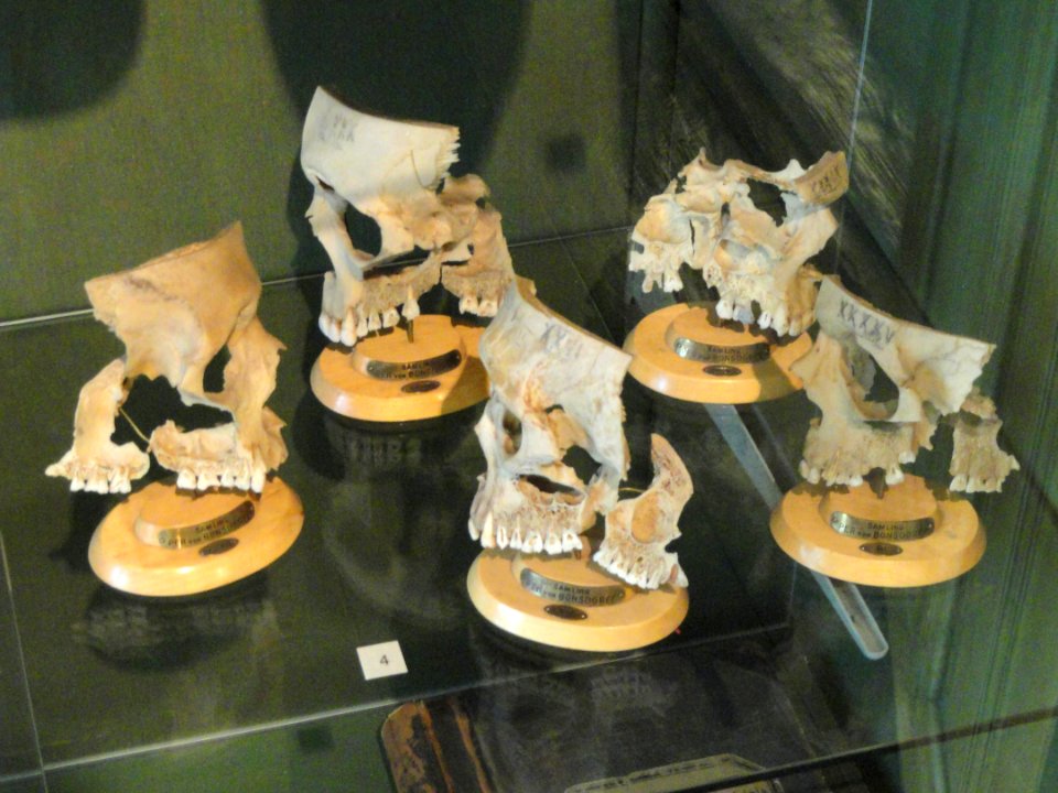 Teeth in skulls - Arppeanum - DSC05430