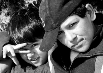 Expression rash black and white