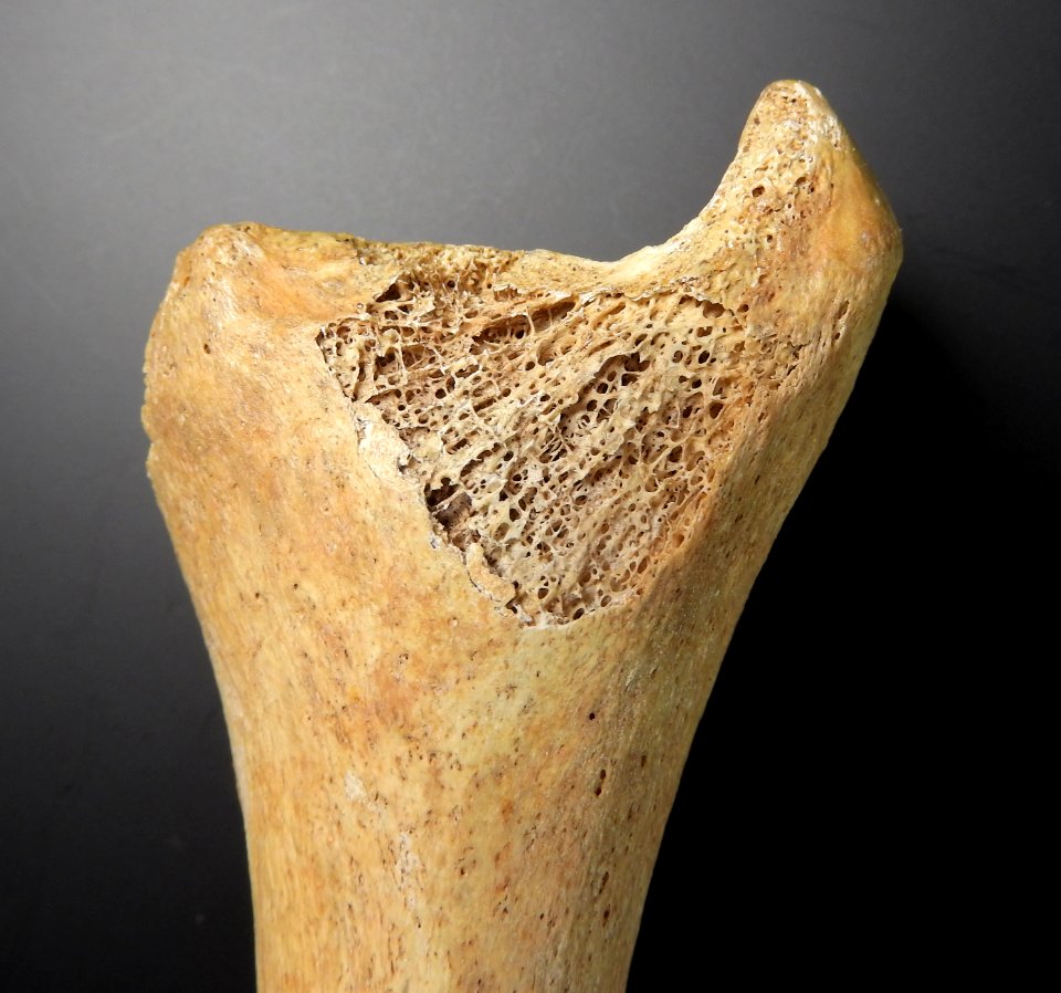 Tibia - detail of malleolus medialis bone tissue