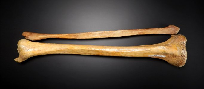 Tibia, fibula (anterior)