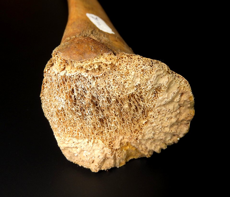 Radius - detail of bone tissue (distal end)