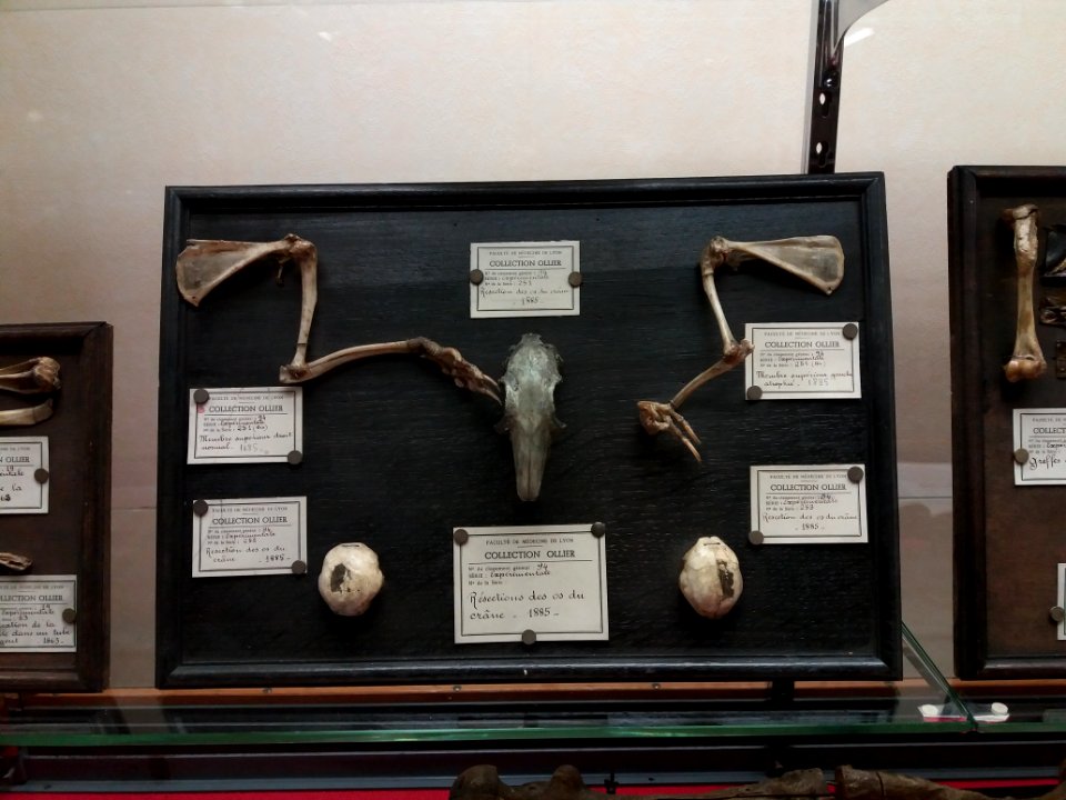 Rillieux-la-Pape - Musée Testut-Latarjet, collection Léopold Ollier, resection d'os du crâne et de membres supérieurs