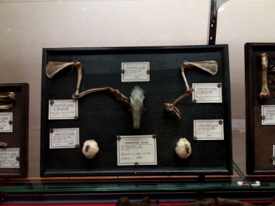 Rillieux-la-Pape - Musée Testut-Latarjet, collection Léopold Ollier, resection d'os du crâne et de membres supérieurs