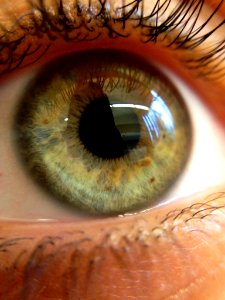 Right Eye (68241445)