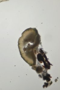 Trapeliopsis granulosa 80994004
