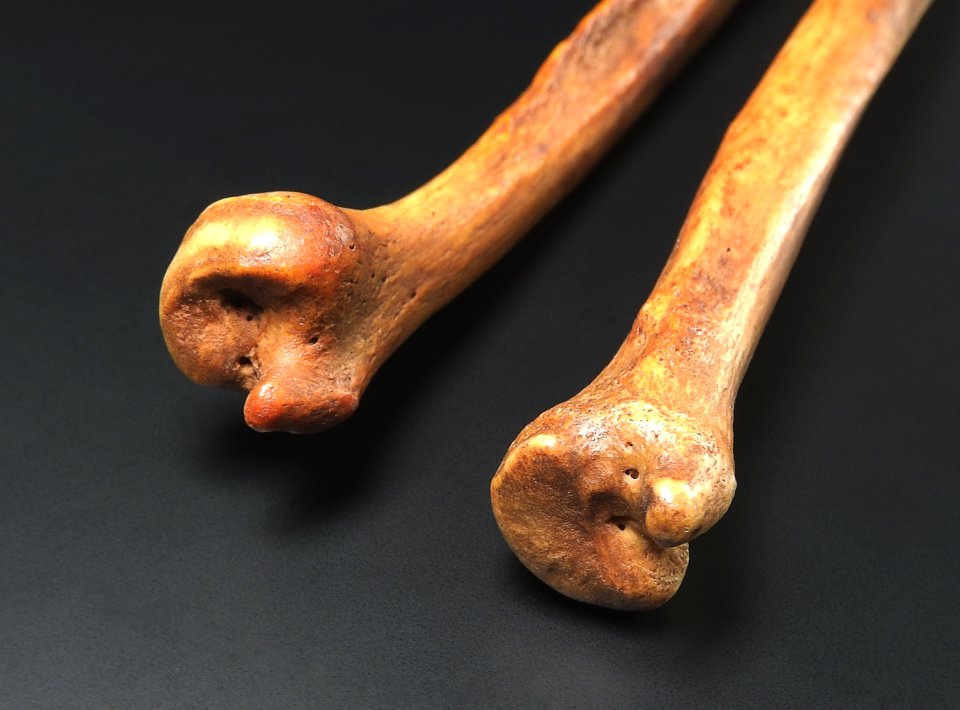 Ulna - distal end