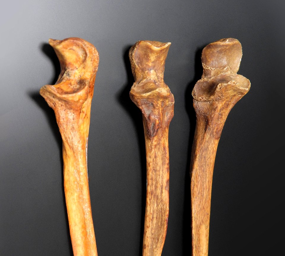 Ulna - olecranon (anterior, lateral)