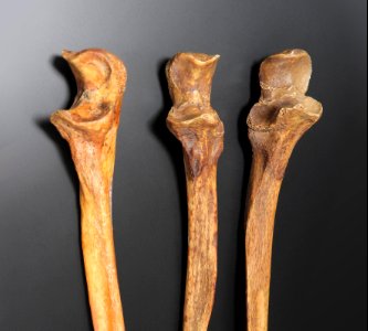 Ulna - olecranon (anterior, lateral)