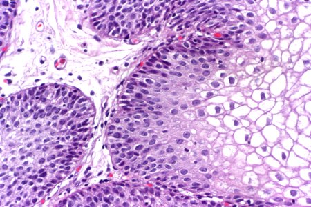 Urinary bladder with glycogenated squamous epithelium, very high mag