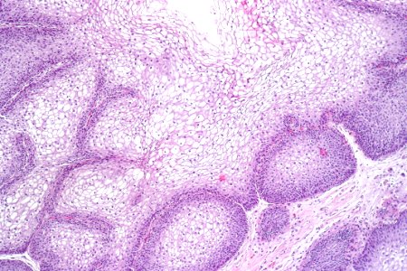 Urinary bladder with glycogenated squamous epithelium, intermed. mag