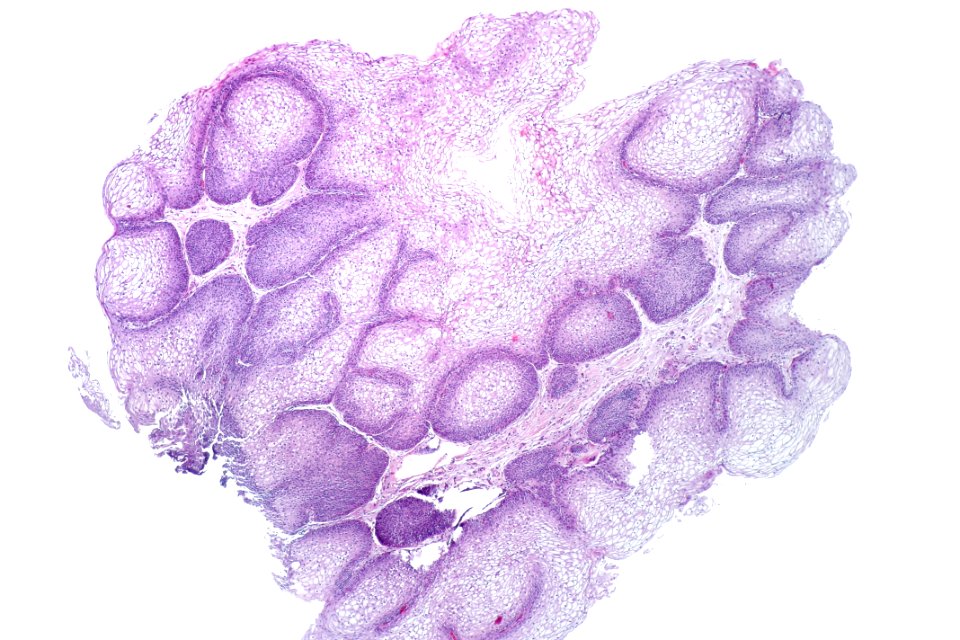 Urinary bladder with glycogenated squamous epithelium, low mag