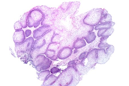 Urinary bladder with glycogenated squamous epithelium, low mag