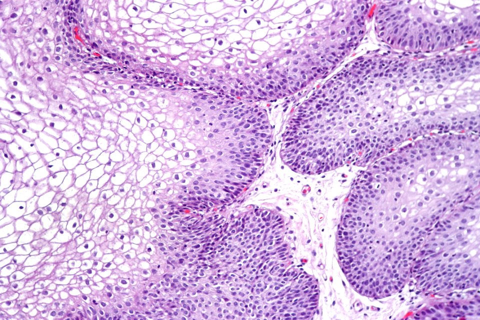 Urinary bladder with glycogenated squamous epithelium, high mag