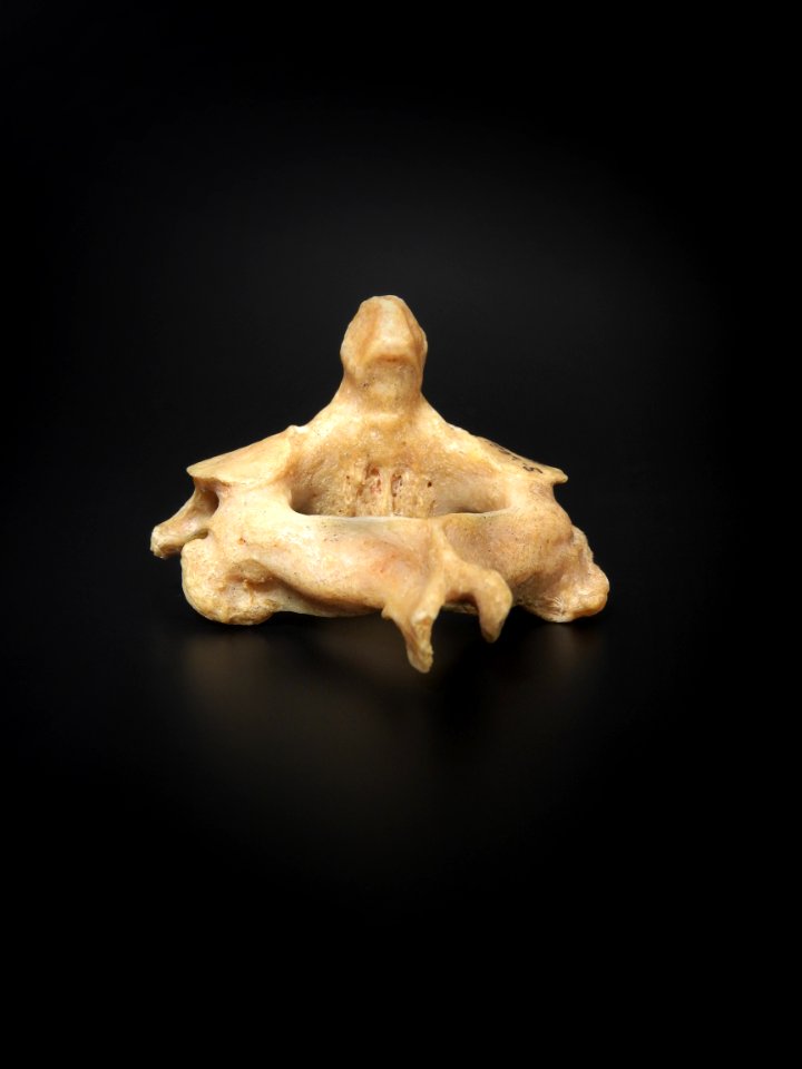 Vertebra - axis (posterior)