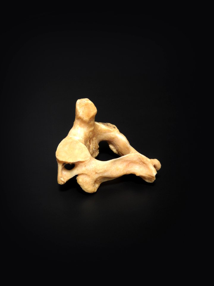 Vertebra - axis (lateral view)