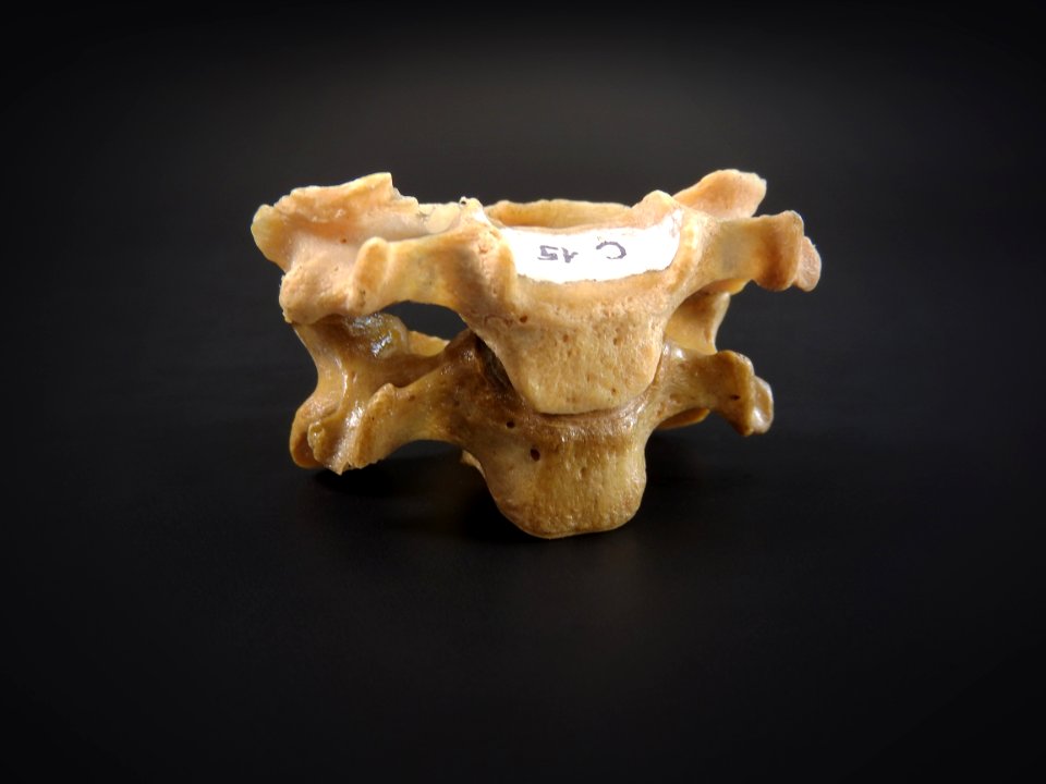 Vertebra - cervicales (anterior)