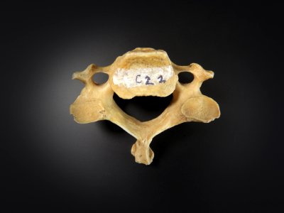 Vertebra - cervicales (from below) photo