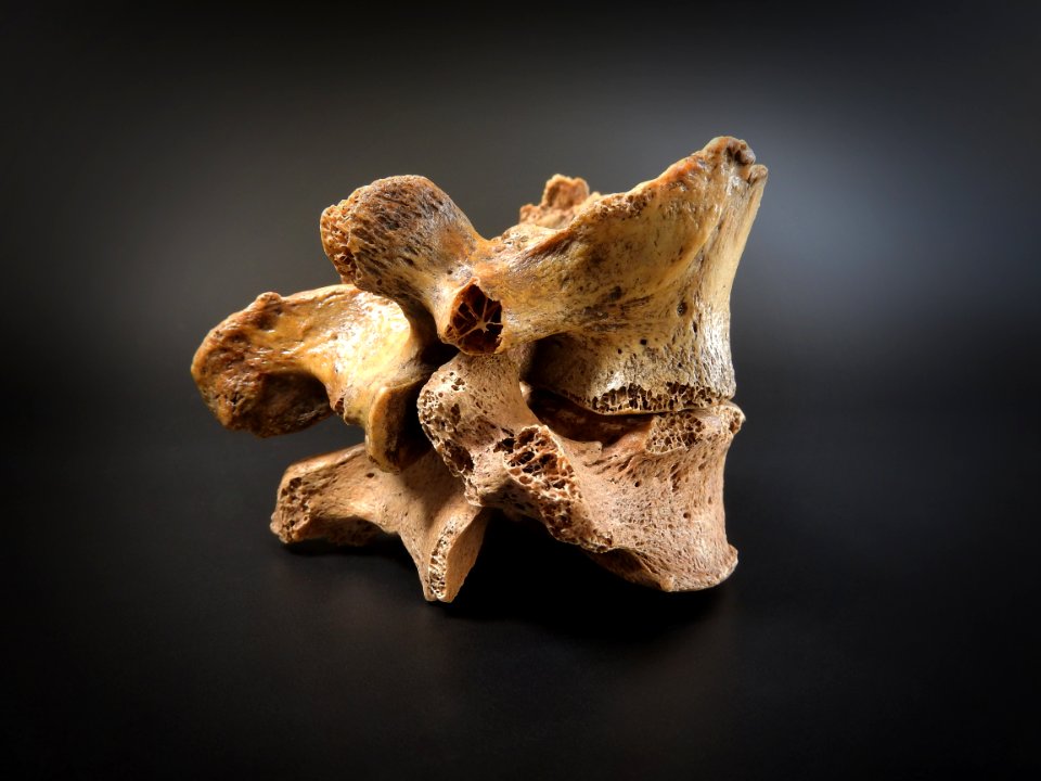 Vertebrae - lumbales (lateral view)