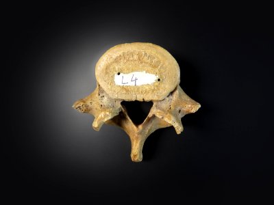 Vertebra - lumbales (superior)