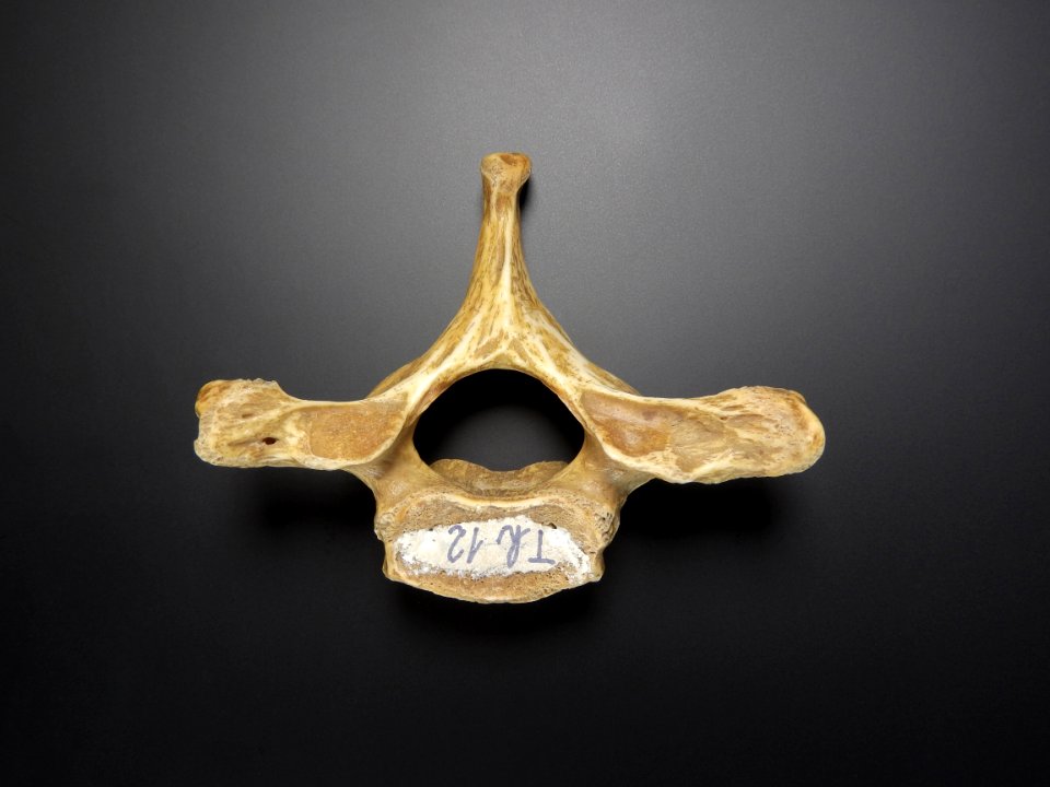 Vertebra - thoracicae (top view)