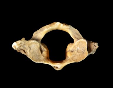 Vertebra - atlas photo