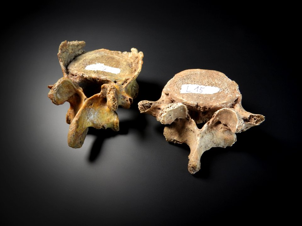 Vertebrae - lumbales