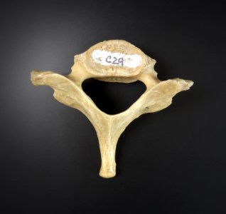 Vertebra - cervicales photo