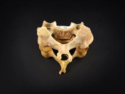 Vertebra - cervicales (posterior) photo