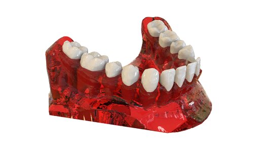 3d model orthodontics the implant