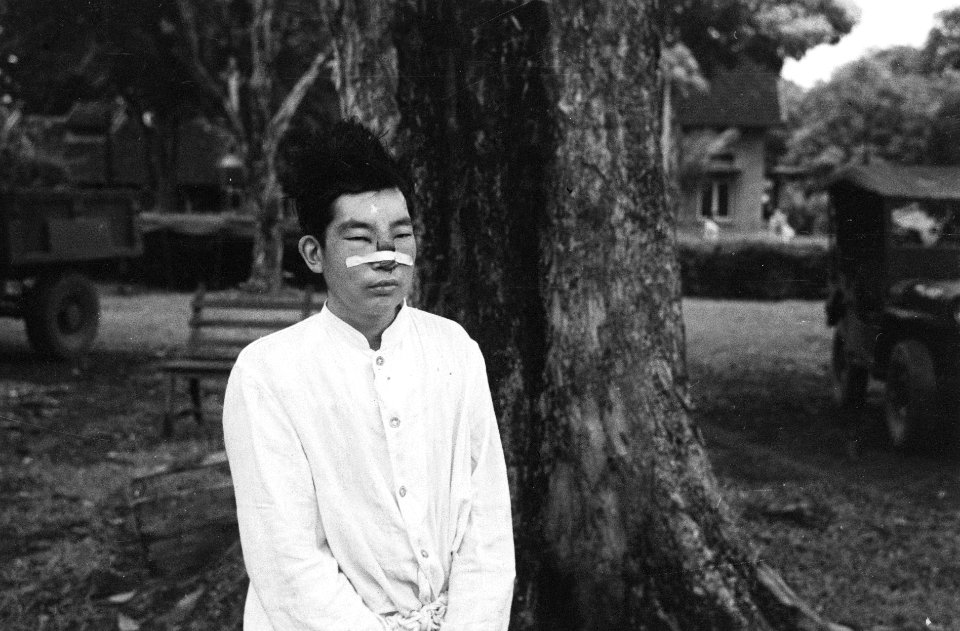 Chinese man met zwaar verwonde neus waarover een pleister is geplakt, Bestanddeelnr 7513