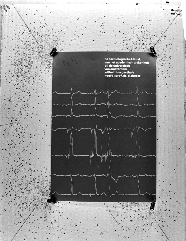 Hartcardiogram, Bestanddeelnr 925-4187