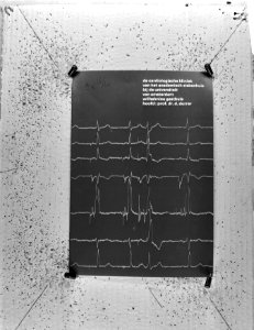 Hartcardiogram, Bestanddeelnr 925-4187