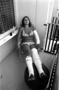 Een zonnend meisje met haar benen en een arm in het verband op een balkon, Bestanddeelnr 928-0838 photo