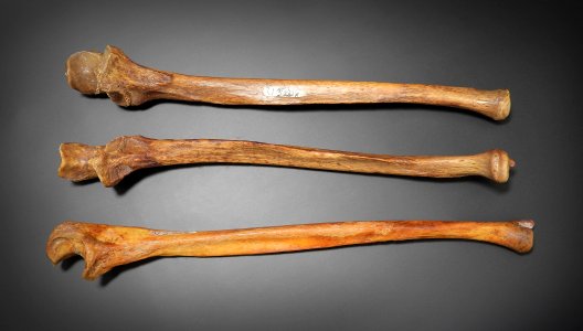 Ulna - lateral, anterior