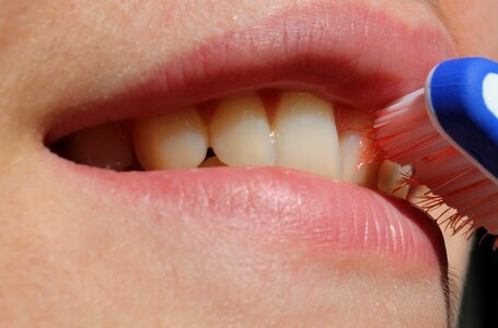 Mouth oral dental photo