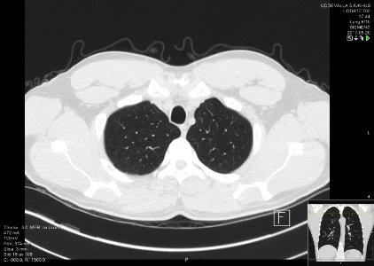 High-resolution computed tomograph of a normal thorax, axial plane (16)