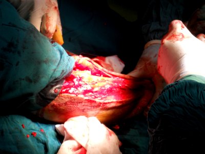 Orthopaedic Surgery